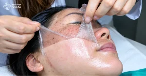 패치 한 장으로 기미를 벗겨낸다? 상테 피부과 전문의가 밝히는 의학적 진실