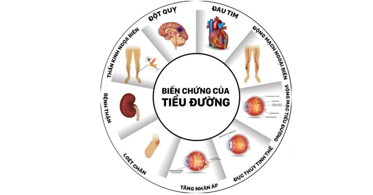 Essential Knowledge for Patients with Diabetes Mellitus (DM) - Image 2 - SANTE Hospital, Binh Thanh, HCMC