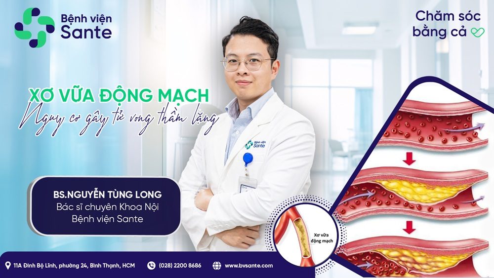 Xơ vữa động mạch – nguy cơ gây tử vong thầm lặng