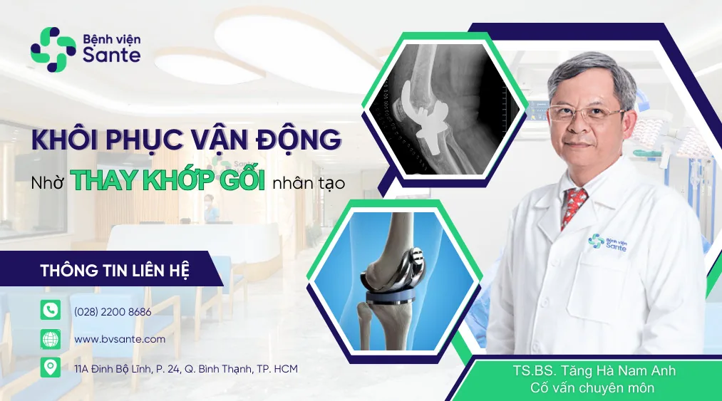 Khôi phục vận động nhờ thay khớp gối nhân tạo - Bệnh viện SANTE Bình Thạnh, TP.HCM