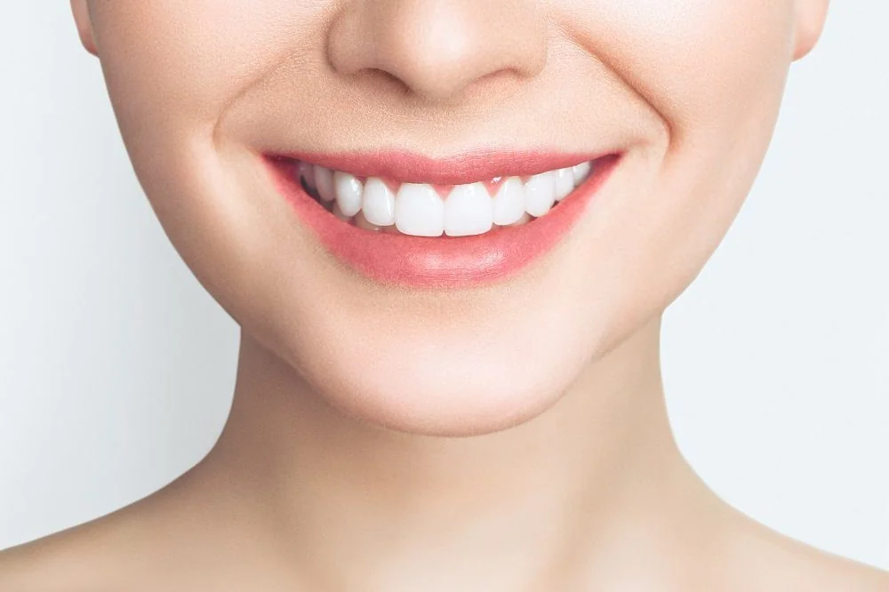 Sante Hospital - Porcelain Veneers (Dental Veneers) (Image 3) Sante Hospital - Porcelain Veneers (Dental Veneers) (Image 3)