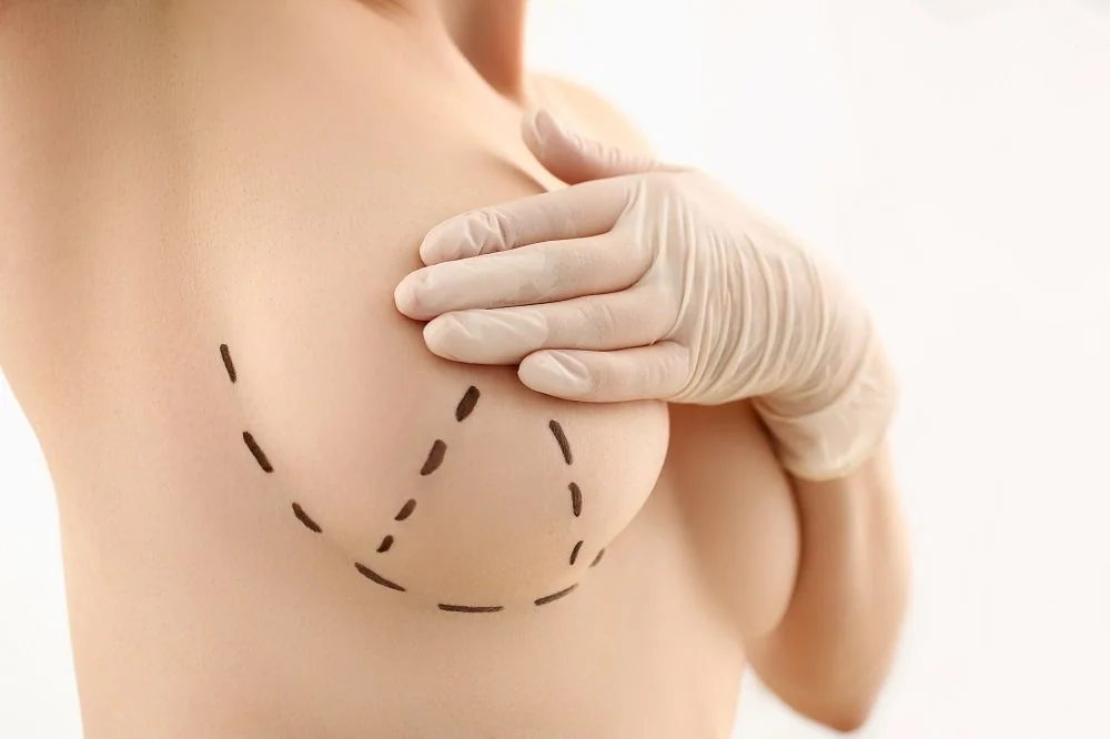 Aesthetic Breast Surgery