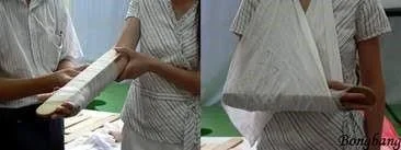 Wooden splint immobilization for fractured limb Wooden splinting for fractured limb immobilization - SANTE Hospital Binh Thanh, HCMC