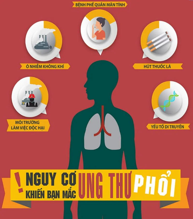 Bệnh viện Sante - Nguyên nhân ung thư phổi_ yếu tố ảnh hưởng_ cách phòng ngừa Bệnh viện Sante - Nguyên nhân ung thư phổi_ yếu tố ảnh hưởng_ cách phòng ngừa