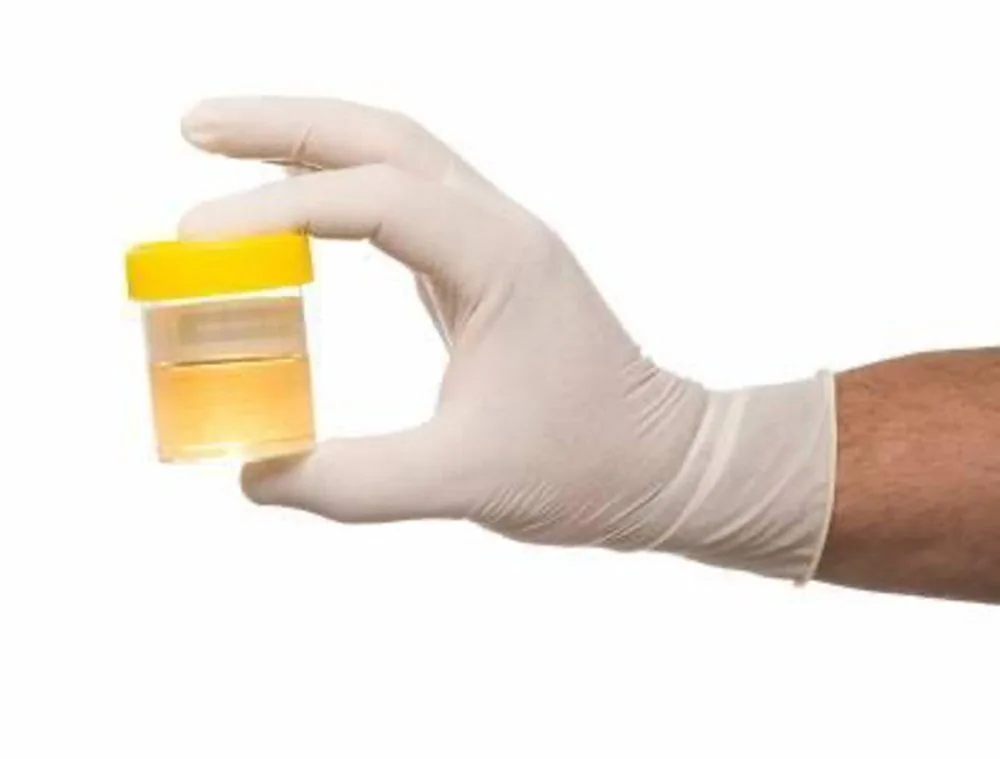 Bệnh viện Sante - Nhiễm trùng tiểu trẻ em (Hình 2)