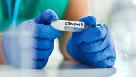 Rapid Antigen and Real-Time RT-PCR COVID-19 Testing
