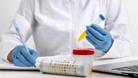 Urinalysis