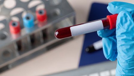 Hematology & Hemostasis