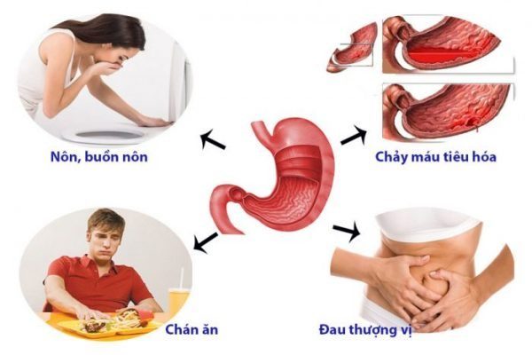 Đau dạ dày: Triệu chứng, cách điều trị và cách phòng tránh