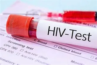 NGÀY THẾ GIỚI PHÒNG TRÁNH AIDS - Hình 2 - Bệnh viện SANTE Bình Thạnh, TP.HCM