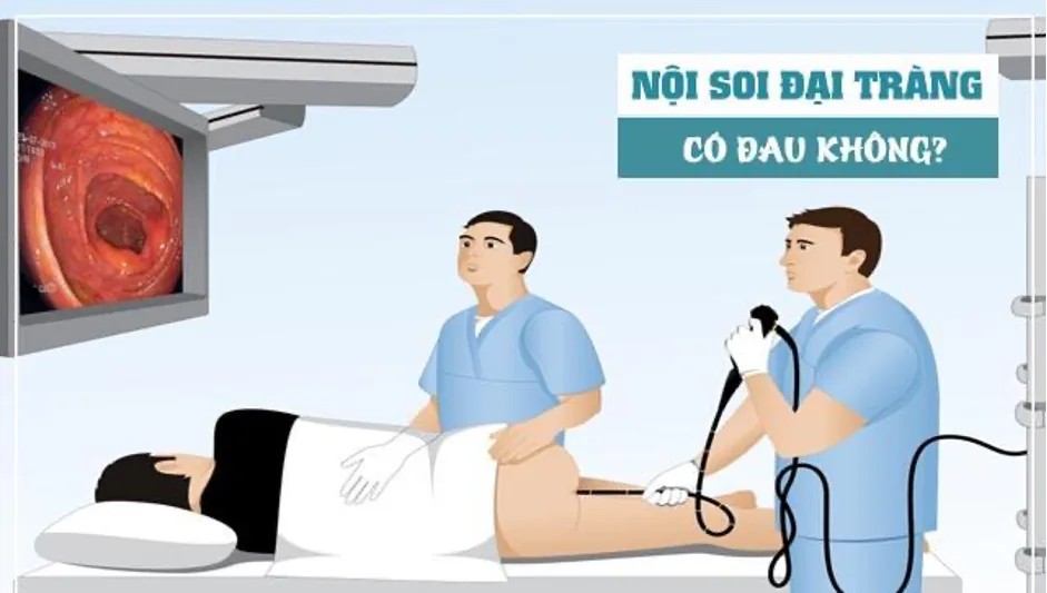 Các phương pháp tầm soát ung thư đại trực tràng - Hình 3 - Bệnh viện SANTE Bình Thạnh, TP.HCM